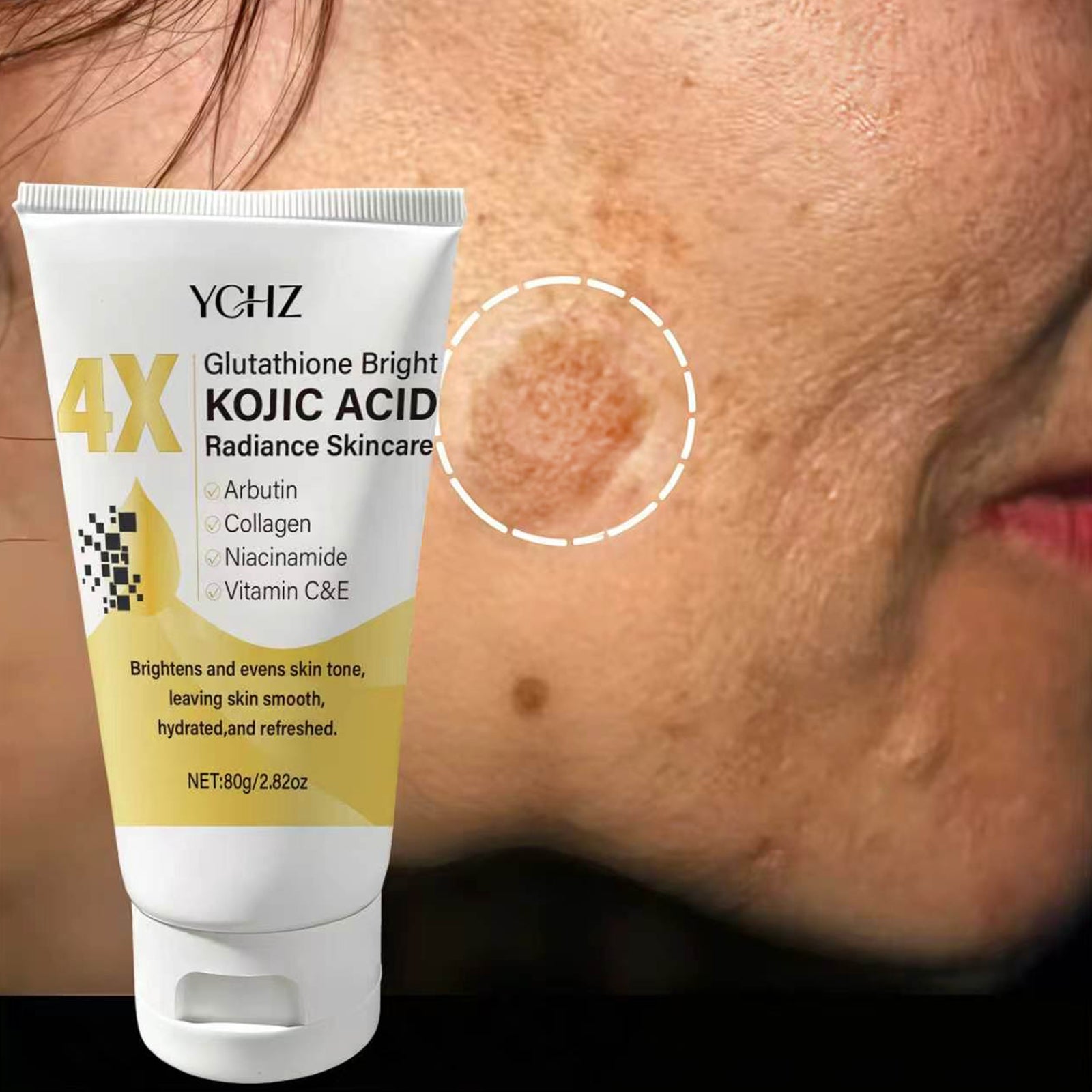 Kojic Acid Face Cream Evens Out Skin Tone