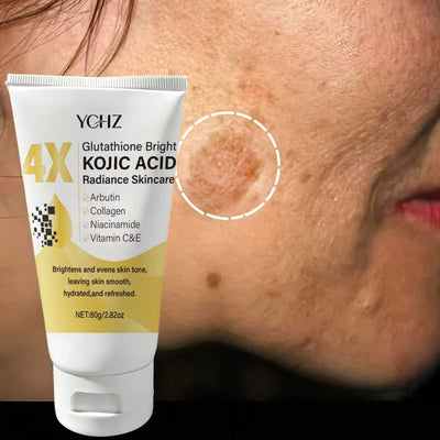Kojic Acid Face Cream Evens Out Skin Tone